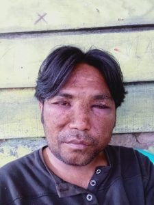 Wartawan Media Online Korba Penganiayaan Penculikan Dan Perampokan Di Daerah Belawan