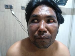 Diduga Polda Sumut Lamban Menangani kasus, Sudah 24 Hari Para Penganiayaan, Penculik dan Perampokan Wartawan  Masih Dalam Pemeriksaan