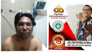 Direktur LBH IPK Kota Medan, JunStar Ritonga Dan Rekan- rekan Angkat Bicara Tentang Penganiayaan,Penculikan Dan Perampokan Terhadap Wartawan 