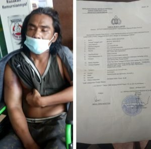 SPKAP Sudah Keluar, Tapi Inisial EN Yang Merupakan Pelaku Penganiayaan Terhadal Supandi, Belum Juga Ditangkap. Supandi : “Apa Lantaran Saya Hanya Orang Kecil”.